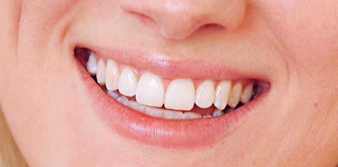 Frauengebiss mit weißen Zähnen